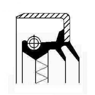 Garnitura diferential